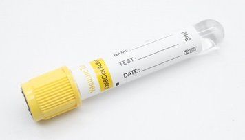 Пробірка з гелем і активатором згортання, вакуумна жовта 3 мл 80325 фото